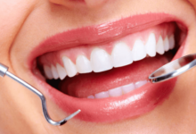 Cosmetic Dentistry Services for a Bright and Beautiful Smile